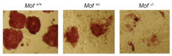 Image: Mouse stem cells with both normally functioning copies of the Mof gene (left) have intact "stem-ness", that is lost in cells lacking one or both functional copies (middle and right) (Photo courtesy of Prof. Yali Dou’s laboratory, University of Michigan).